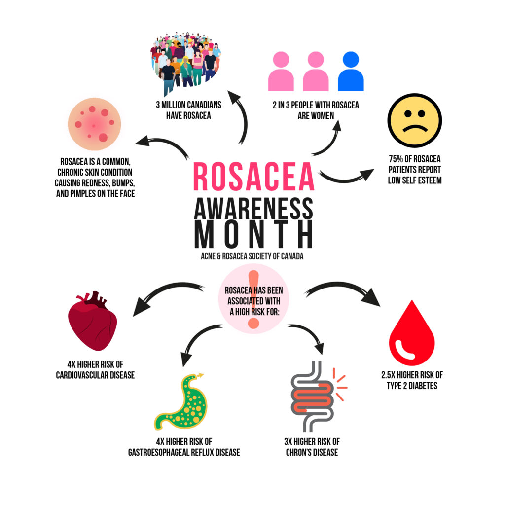 Rosacea Awareness Month