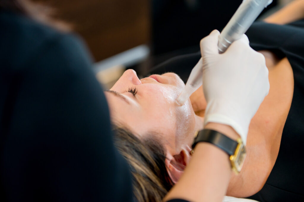 Humphrey Cosmetic Dermatology, Vancouver, British Columbia, Microneedling with PRP